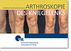 Kniegelenk: Arthroskopie